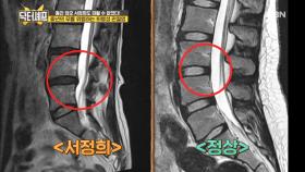 ＂비가 오면 관절이 쑤셔요...＂ 서정희, 관절 건강에 적신호??