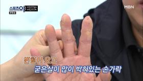손이 나의 인생이다, 세계 정상의 아름다운 손!