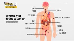 담배가 건강에 얼마나 안 좋을까?