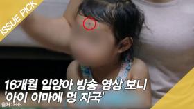 16개월 입양아 방송 영상 보니 '아이 이마에 멍 자국'