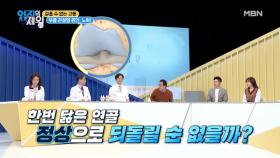 ※집중※ 한번 닳은 연골 정상으로 되돌릴 수 있을까? MBN 210223 방송