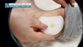 독소 배출에 도움이 된다? 발바닥 양파 찜질의 진실 MBN 210423 방송