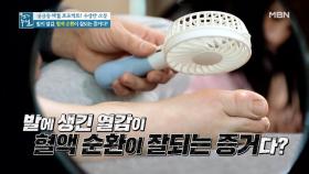 후끈한 발의 열감, 혈관 건강의 적신호다? MBN 210423 방송