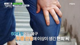 그녀에게 관절염이 생긴 이유는? 〣(ºΔº)〣 MBN 210504 방송