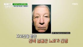 ◆피부 건강 적신호◆ 그 원인은? MBN 210517 방송