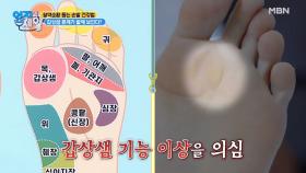 발이 보내는 전신 통증 신호! 갑상샘 문제가 발에 보인다?! MBN 210608 방송