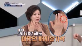 문영미와 이희구의 무릎 외 다른 관절 상태는? ＂손가락에도 관절염이?＂ MBN 240309 방송