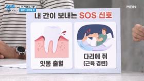 ※내 간이 보내는 SOS신호※ 잇몸 출혈과 다리에 쥐가 연관이 있다? MBN 240924 방송