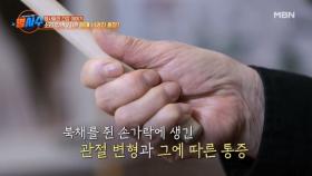 국악 명창 신영희의 몸에 남겨진 훈장? 그녀가 걸어온 고단한 길… MBN 241030 방송