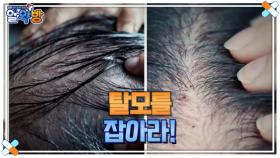 알약방 229회 ＜일상과 삶의 질을 무너뜨리는 탈모를 잡아라!＞ 미리보기 MBN 241114 방송