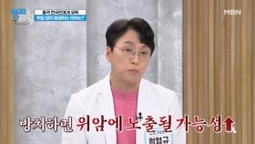 방치하면 암 된다! 위암 위험 신호는?? 『위 건강 자가 진단법』 MBN 241210 방송