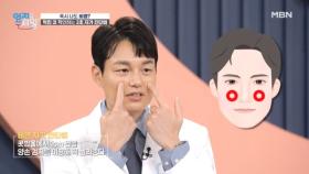 비염 때문에 고혈압, 뇌졸중, 돌연사까지...? 감기인지 비염인지 구별하는 방법은?? MBN 250715 방송