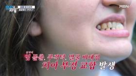 입 돌출, 얼굴 비대칭, 치아 부정 교합까지... 비염 방치하면 얼굴형이 변할 수 있다?! MBN 250715 방송