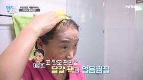 ☆중년 탈모 공략법☆ 달걀 팩과 얼음 찜질이 탈모에 효과적이다?! MBN 251007 방송