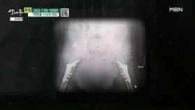 고관절 수술을 한 아들 MBN 251103 방송