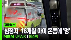 [자막뉴스] ＂숨을 안 쉬어요!＂ 심정지 아이 온몸에 멍이… | 이슈픽