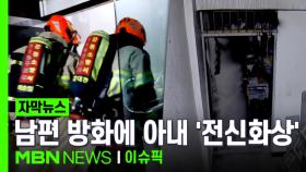 [자막뉴스] 부부싸움 중 남편이 불질러…40대 아내 전신화상에 