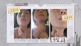 요가와 목 쓰다듬으로 건강을 챙겨라 MBN 251214 방송