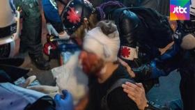 프랑스 보안법 규탄 시위…경찰·시위대 부상 속출｜브리핑 ON