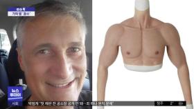 [이슈톡] 백신 거부 이탈리아 치과의사‥'가짜 팔' 내밀었다 덜미