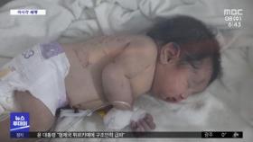 [이 시각 세계] 시리아 붕괴 건물서 구조된 신생아‥건강한 모습 공개