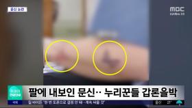 [와글와글] 팔에 내보인 문신‥누리꾼들 갑론을박