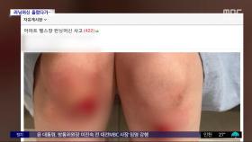 [와글와글 플러스] 러닝머신 켜진 줄 모르고 타다 '꽈당'