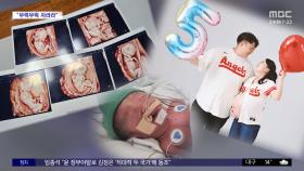 [와글와글 플러스] 다섯쌍둥이 지원금 1억 7천만 원 이상