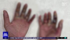 '방사선 피폭' 사고 삼성전자‥'중대재해' 조사