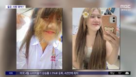 [와글와글] 태국 '늑대 소녀' 달라진 모습 공개