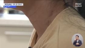 시퍼렇게 멍든 이주노동자‥