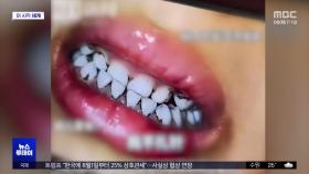 [이 시각 세계] 중국 유치원서 어린이 70명 집단 납중독