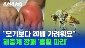 [스브스뉴스] 여름 벌레 끝판왕! 생살 찢어 피 빠는 한국 흡혈 파리 클라스;;