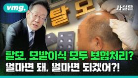 [사실은] 탈모가 끝은 아니다…