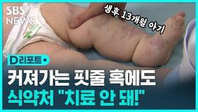 [D리포트] 코끼리 다리 아기…치료 못 받는 사연