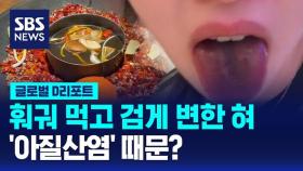 [글로벌D리포트] 훠궈 먹고 검게 변한 혀…'아질산염' 때문?