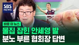 물집 잡힌 안세영 발…배드민턴협회장 