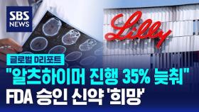 [글로벌D리포트] FDA 승인 새 알츠하이머 약, 희망으로