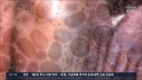 18개국 전파 '원숭이두창' 반려동물 전염시 풍토병 우려
