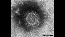 일본 '신종코로나 감염 신속 확인' 간이검사법 개발 착수