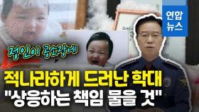 [영상] 뼈 부러뜨리기 반복…정인이 공소장에 고스란히 드러난 잔혹성