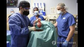 미 연구팀, 유전자 조작 돼지심장 첫 인체 이식…사흘째 회복중(종합)
