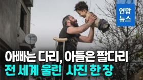 [영상] '그래도 우린 행복'…전 세계 울린 '몸통 소년' 부자유친