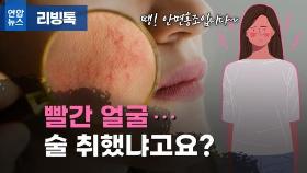 [리빙톡] 술 취했냐고요?…'이 증상' 때문이랍니다