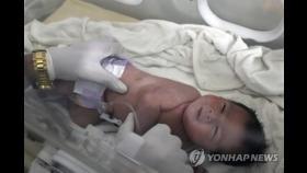[튀르키예 강진] 시리아 붕괴현장 구조된 신생아 치료받고 건강 회복