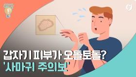 [리빙톡] 갑자기 피부가 오돌토돌?…'사마귀 주의보'