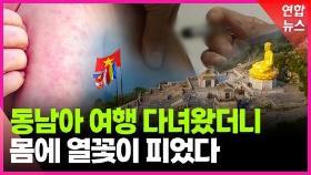 [영상] 전 세계 홍역 유행이라는데…