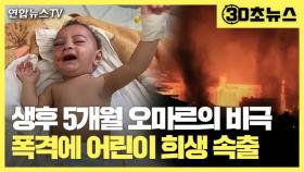 [30초뉴스] 생후 5개월 오마르의 비극…폭격에 어린이 희생 속출