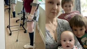 [SNS핫피플] 뱃속 아기 위해 암치료 포기…다리 절단한 英 엄마 外