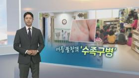 [알면좋은뉴스] '수족구병' 증가세…손 씻기 등 위생수칙 지켜야 外